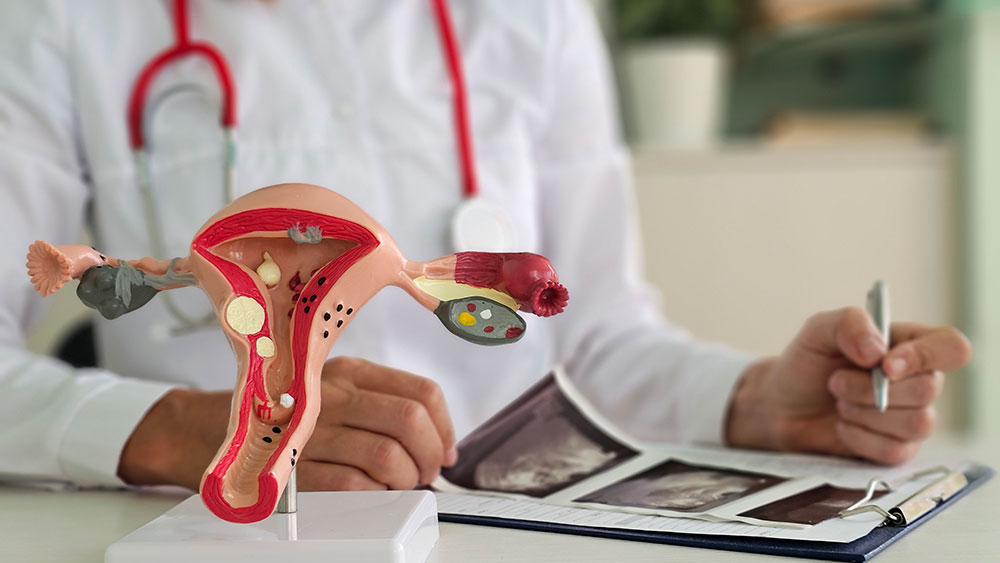 Gynäkologische Vorsorgeuntersuchung